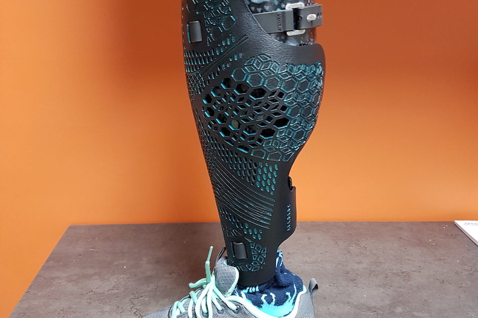 Behind the Covers: PBO Group’s Take on Today’s Prosthesis Covering Options